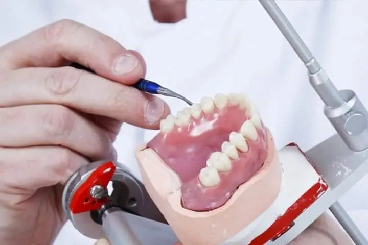 Redenen voor een kunstgebit